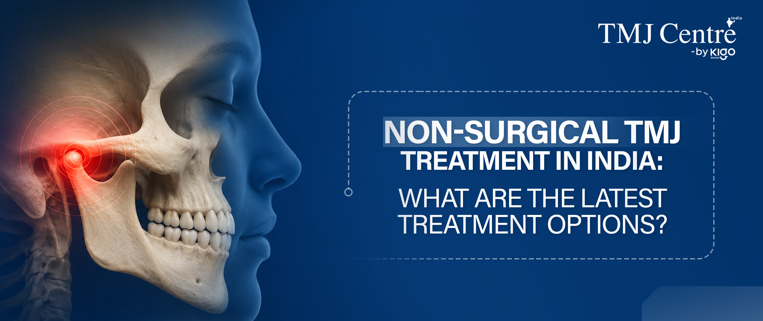 Non-Surgical TMJ Treatment in India
